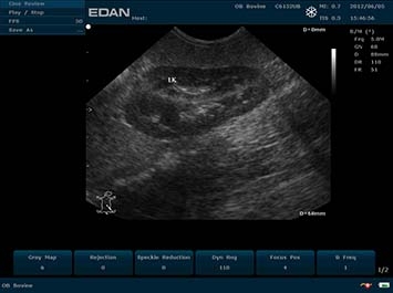 EDAN U50 VET