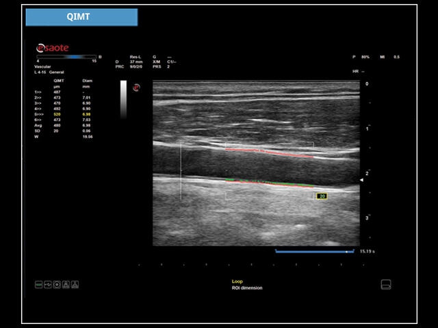 Esaote MyLab X6