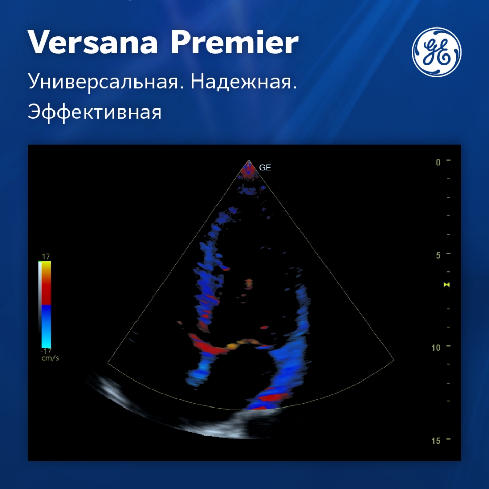 GE Versana Premier Platinum