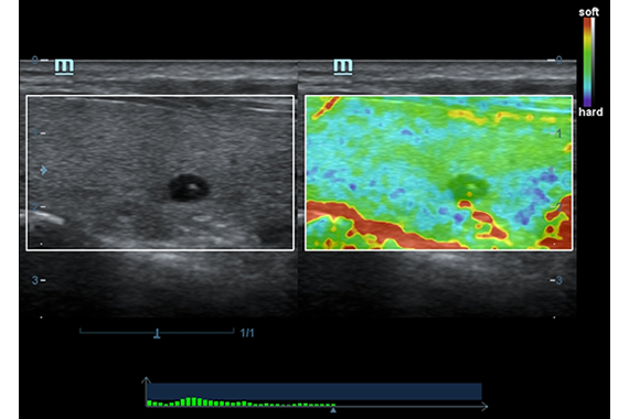 Mindray DC-60 Exp X-Insight