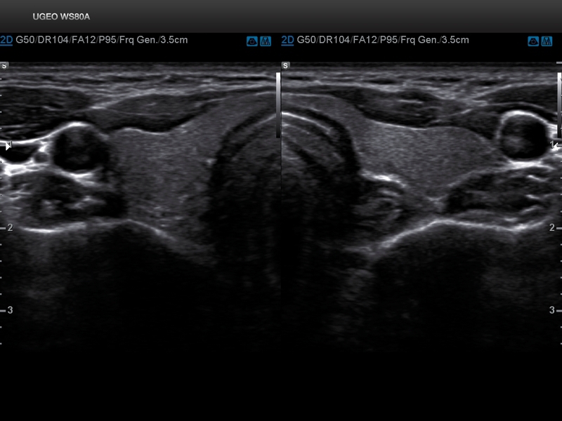 Samsung WS80