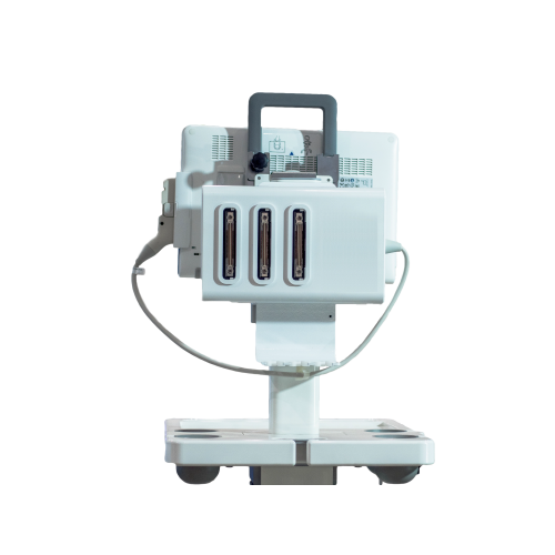 Philips InnoSight