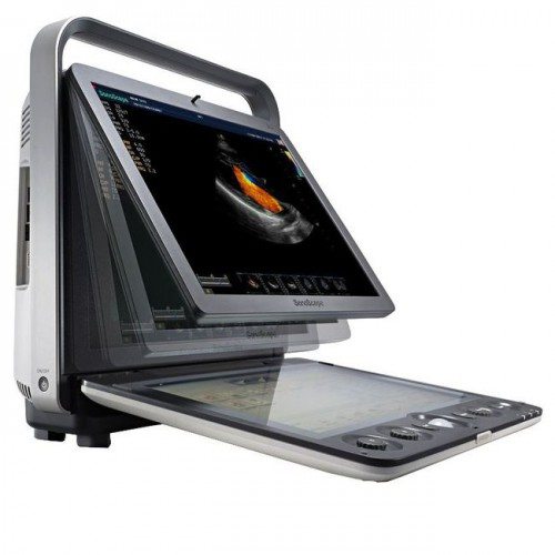 Sonoscape S9
